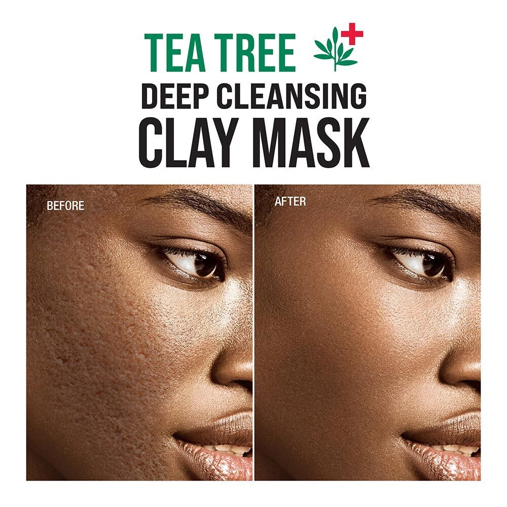 KISS TEA TREE DEEP CLEANSING CLAY MASK